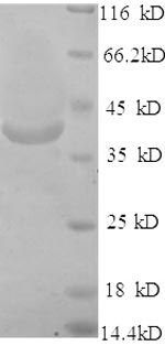 SDS-PAGE