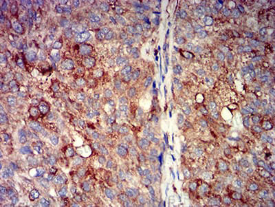 Валидация AntibodySystem RHE18301 (2017)
