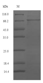 SDS-PAGE