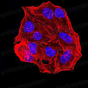 Валидация IF - AntibodySystem RHC03210 (250)