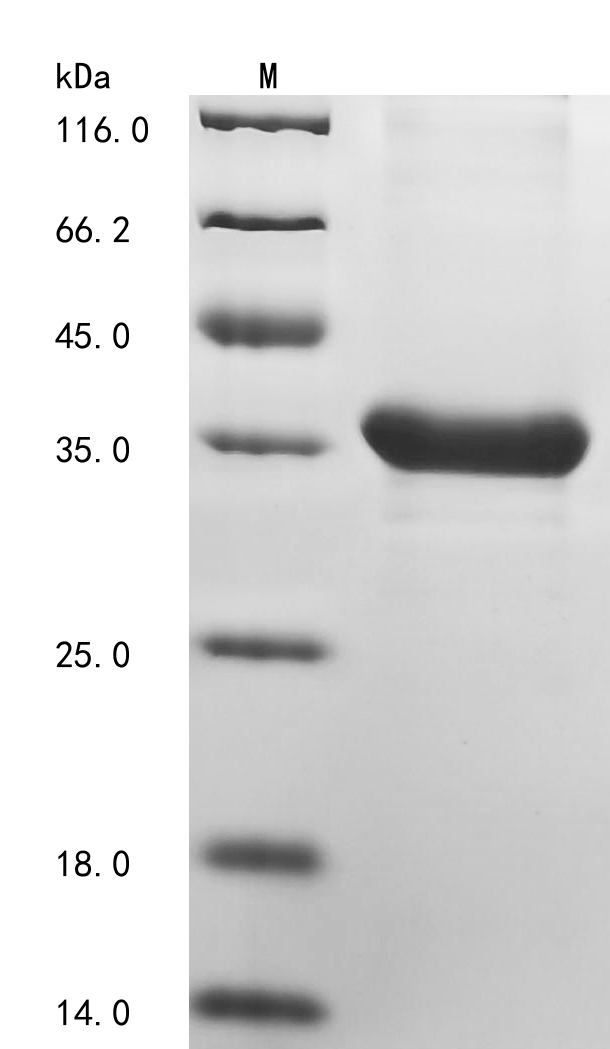 SDS-PAGE