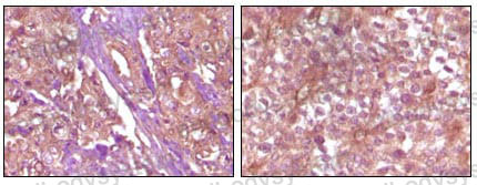 Валидация AntibodySystem RHF05103