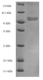 SDS-PAGE