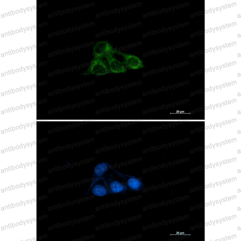 Валидация IF - AntibodySystem RHK93001