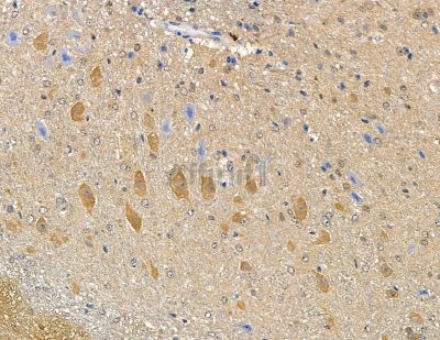 Валидация Affinity DF8618 - 20544