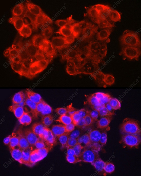 Иммунофлуоресценция, SSCA1/SerpinB3, клетки HepG2