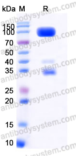 EHD66901, SDS-PAGE