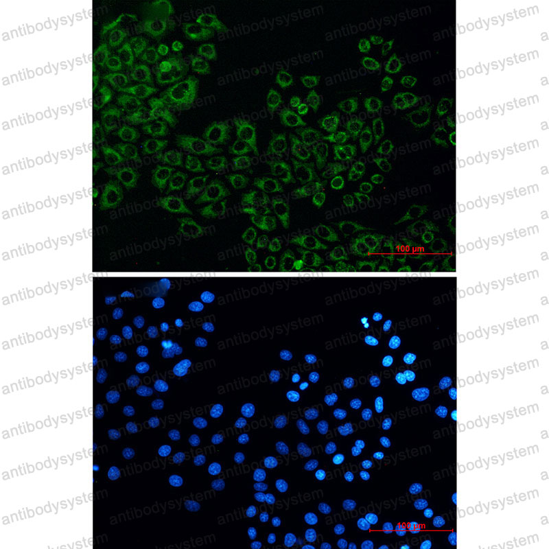 Валидация IF - AntibodySystem RHB18501