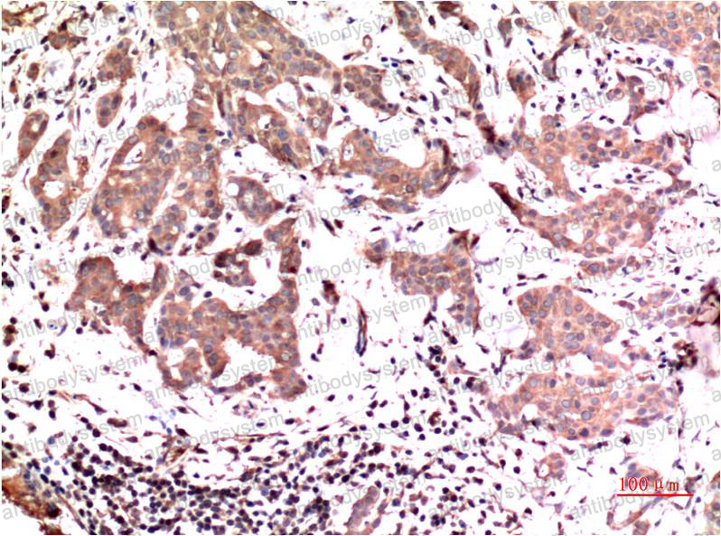 Валидация AntibodySystem RHD73613