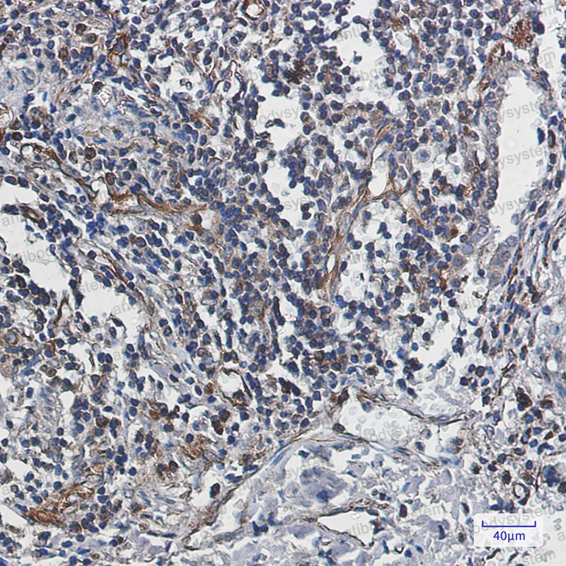 Валидация AntibodySystem RHJ33801