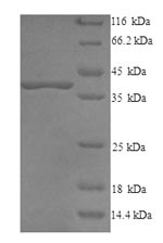 SDS-PAGE