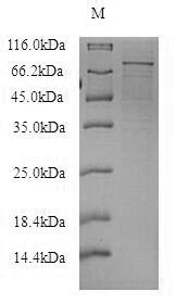 SDS-PAGE