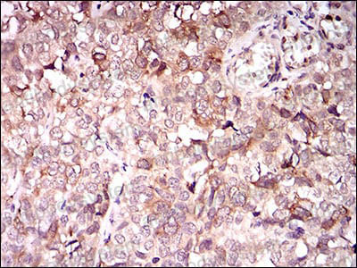 Валидация AntibodySystem RHE93203