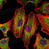 Валидация IF - AntibodySystem RHE27705