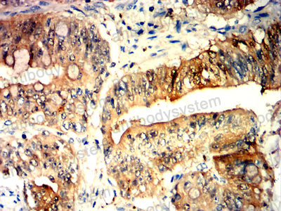 Валидация AntibodySystem RHD06603