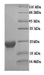 SDS-PAGE