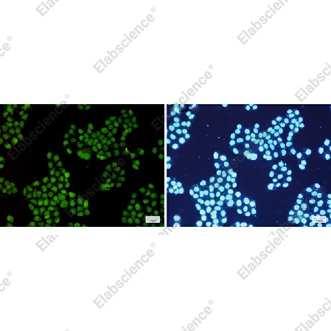 Иммунофлуоресценция, CDK2, клетки HeLa
