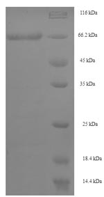 SDS-PAGE