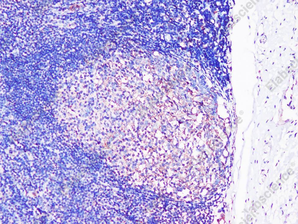 Иммуногистохимия, IL-17A, ткань тонкой кишки человека