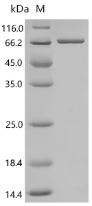 SDS-PAGE