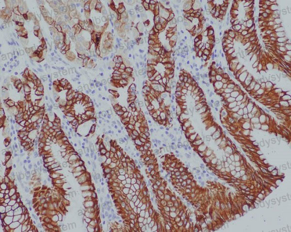 Валидация AntibodySystem RHB98001