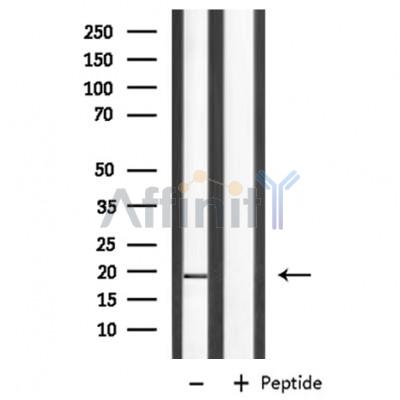 Валидация Affinity DF8583 - 20492