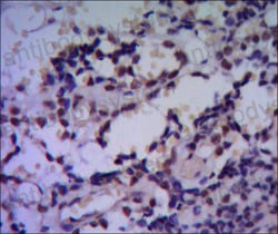 Валидация AntibodySystem RHE05802