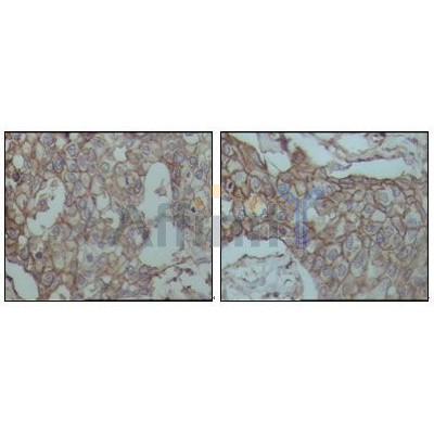 Валидация Affinity BF9213 - 5424