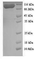 SDS-PAGE