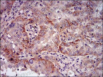 Валидация AntibodySystem RMN92902