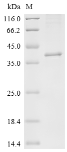 SDS-PAGE