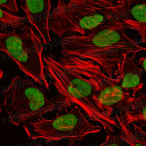 Валидация IF - AntibodySystem RHC96101