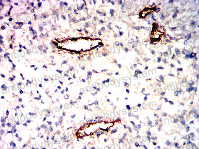 Валидация AntibodySystem RHD26503