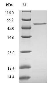 SDS-PAGE