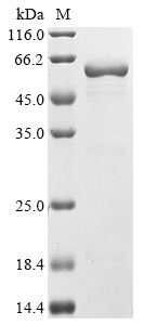 SDS-PAGE