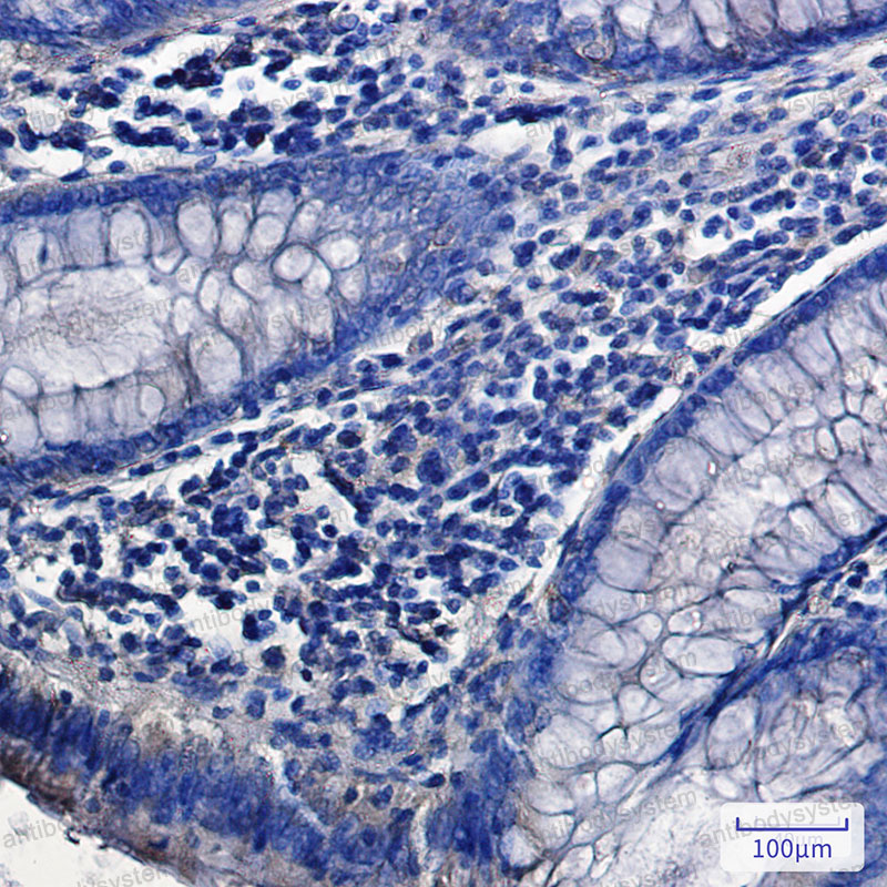 Валидация AntibodySystem RHJ89901