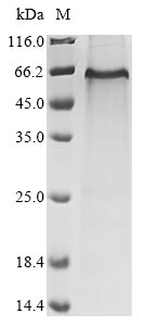SDS-PAGE