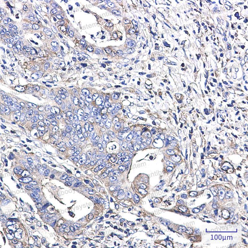 Валидация AntibodySystem RHF61303