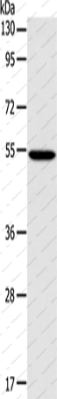 Вестерн-блоттинг, ERG, клетки 293T