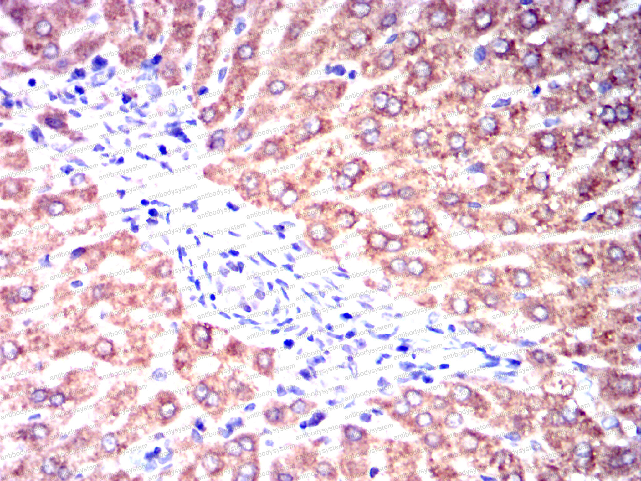 Валидация AntibodySystem RHD38803 (1552)