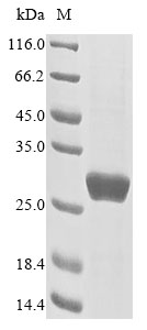 SDS-PAGE