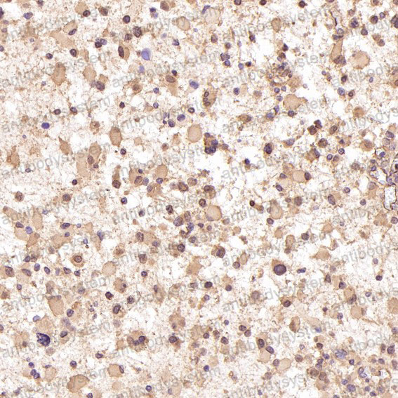 Валидация AntibodySystem RHD96504 (1877)