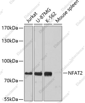 Вестерн-блоттинг, NFAT2, различные клеточные линии