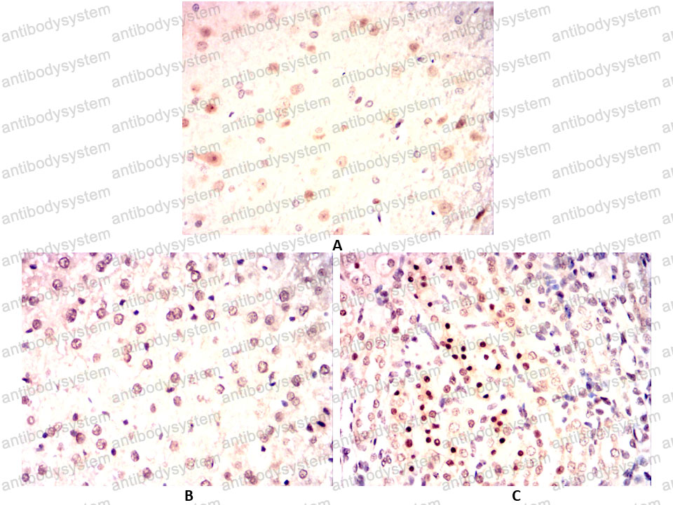 Валидация AntibodySystem RHD35301 (1519)