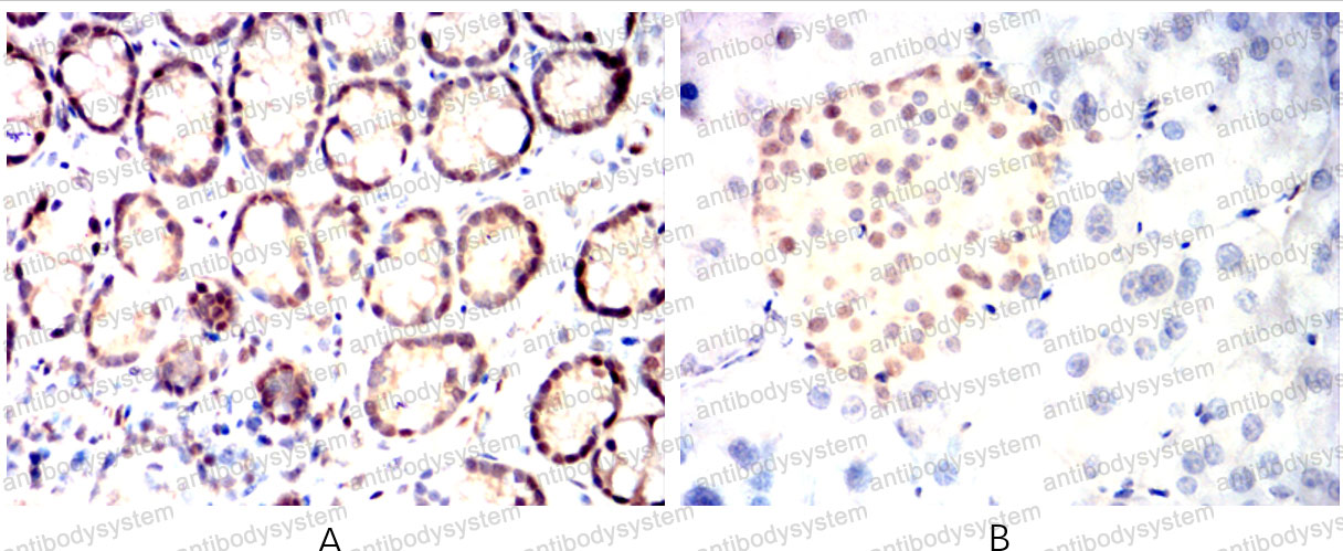 Валидация AntibodySystem RHC09001 (608)