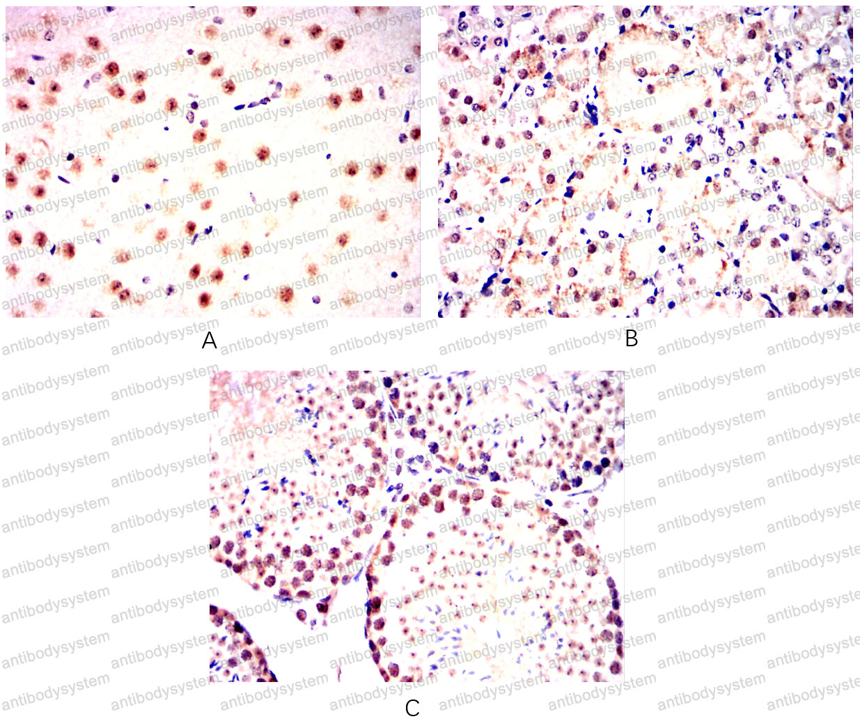 Валидация AntibodySystem RHF42902 (2509)
