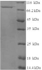 SDS-PAGE
