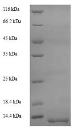 SDS-PAGE