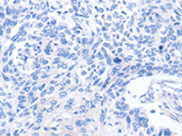 Валидация AssayVector ARM1849(2439)