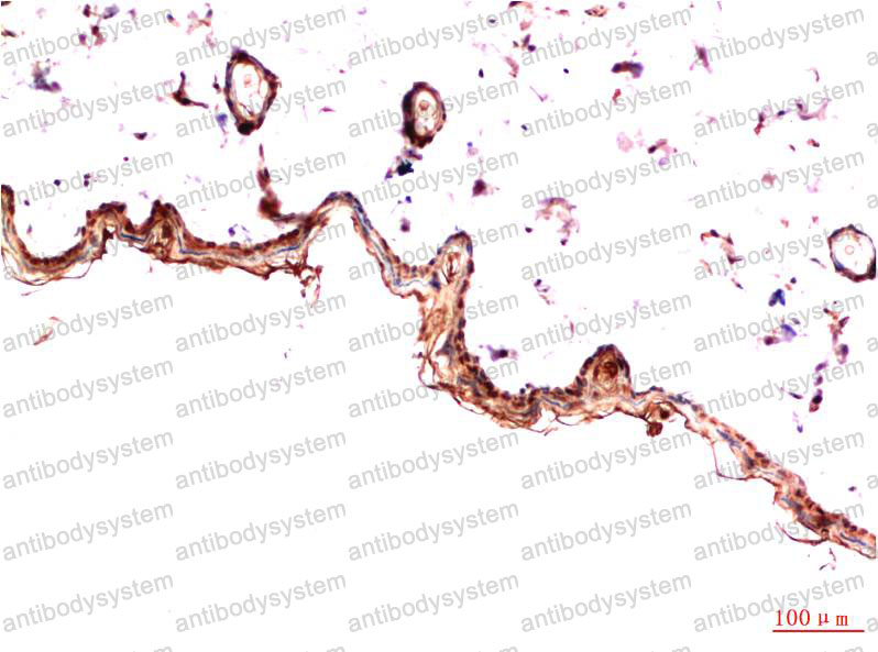 Валидация AntibodySystem RHD16107 (1374)